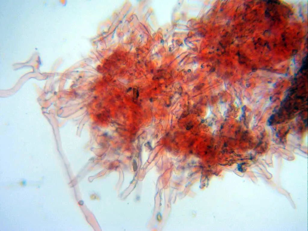 Microscopía de Rhizopogon roseolus - 10 - Hifas peridio x 400